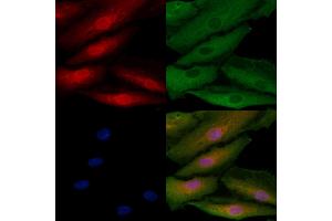 ABIN6260082 and ABIN6272540 staining  cells by IF/ICC.
