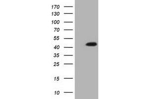Western Blotting (WB) image for anti-Isovaleryl-CoA Dehydrogenase (IVD) antibody (ABIN1498919) (IVD 抗体)