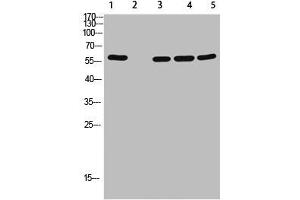 Western Blot analysis of 1,mouse-lung 2,mouse-spleen 3,mouse-kidney 4,mouse-heart 5,293 cells using primary antibody diluted at 1:500(4 °C overnight). (AVPR2 抗体  (AA 1-50))