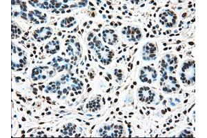 Immunohistochemical staining of paraffin-embedded breast tissue using anti-TYRO3 mouse monoclonal antibody.