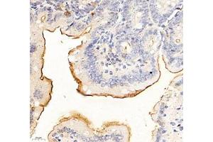 Immunohistochemistry of paraffin embedded mouse duodenum using ADCY4 (ABIN7072959) at dilution of 1: 700 (400x lens) (ADCY4 抗体)