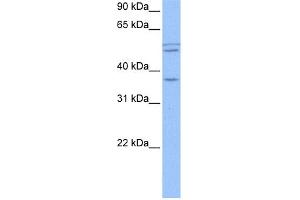WB Suggested Anti-CCDC78 Antibody Titration: 0. (CCDC78 抗体  (Middle Region))