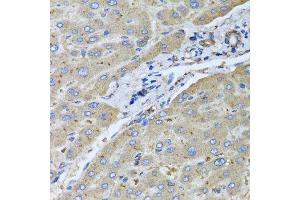 Immunohistochemistry of paraffin-embedded human liver injury using UGT2B10 antibody at dilution of 1:100 (x40 lens). (UGT2B10 抗体)