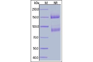 Biotinylated Human ITGAV&ITGB8 Heterodimer Protein, His,Avitag&Tag Free on  under ing (NR) condition. (ITGAV/ITGB8 Protein (AA 31-992) (His tag,AVI tag,Biotin))