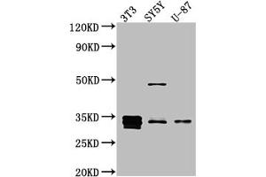 Western Blot Positive WB detected in: NIH/3T3 whole cell lysate, SH-SY5Y whole cell lysate, U-87 whole cell lysate All lanes: Cyclin D1 antibody at 1:1000 Secondary Goat polyclonal to rabbit IgG at 1/50000 dilution Predicted band size: 34 kDa Observed band size: 34 kDa (Recombinant Cyclin D1 抗体)