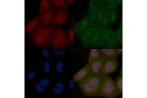 USP21 Mouse Monoclonal Antibody staining Hela cells by IF/ICC. (USP21 抗体)