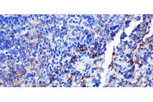 Immunohistochemistry of paraffin-embedded Mouse spleen using CD68 Polyclonal Antibody at dilution of 1:100 (40x lens). (CD68 抗体)
