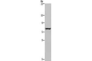 Gel: 6 % SDS-PAGE, Lysate: 40 μg, Lane: Hela cells, Primary antibody: ABIN7130441(NOC2L Antibody) at dilution 1/200, Secondary antibody: Goat anti rabbit IgG at 1/8000 dilution, Exposure time: 5 seconds (NOC2L 抗体)