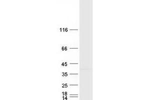 Western Blotting (WB) image for Rhomboid Domain Containing 1 (RHBDD1) protein (Myc-DYKDDDDK Tag) (ABIN2730838)