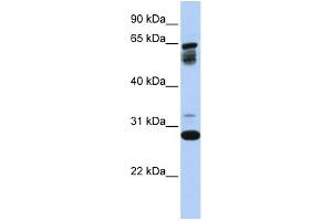WB Suggested Anti-TMEM187 Antibody Titration:  0. (TMEM187 抗体  (Middle Region))