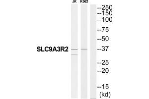 Western blot analysis of extracts from JK cells and K562 cells, using SLC9A3R2 antibody. (SLC9A3R2 抗体  (N-Term))