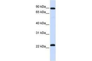 Image no. 1 for anti-Regulator of G-Protein Signalling 19 (RGS19) (N-Term) antibody (ABIN6742424)