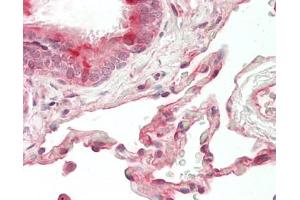 Immunohistochemistry (Paraffin-embedded Sections) (IHC (p)) image for anti-CASP2 and RIPK1 Domain Containing Adaptor with Death Domain (CRADD) antibody (HRP) (ABIN2596500)