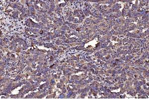 IHC analysis of PDIA6 using anti-PDIA6 antibody (ABIN7600554). (PDIA6 抗体  (AA 20-440))