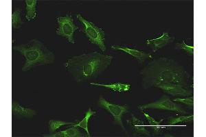 Immunofluorescence of monoclonal antibody to TXK on HeLa cell. (TXK 抗体  (AA 131-230))
