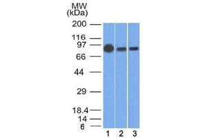 Western blot testing of human 1) A431, 2) A549 and 3) MCF7 cell lysate with Beta Catenin antibody (clone 9F2).
