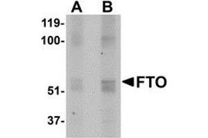 Western blot analysis of FTO in human uterus tissue lysate with AP30350PU-N FTO antibody at (A) 1 and (B) 2 μg/ml. (FTO 抗体  (N-Term))