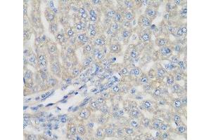 Immunohistochemistry of paraffin-embedded Rat liver using METTL7A Polyclonal Antibody at dilution of 1:200 (40x lens). (METTL7A 抗体)