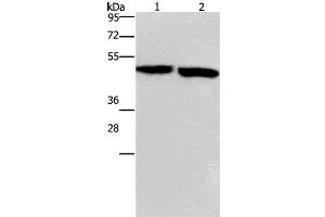 Western Blot analysis of Mouse stomach and brain tissue using CLUAP1 Polyclonal Antibody at dilution of 1:500 (CLUAP1 抗体)