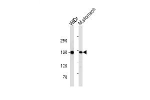 Lane 1: WiDr, Lane 2: mouse stomach lysate at 20 µg per lane, probed with bsm-51214M CDH1 (813CT11. (E-cadherin 抗体)