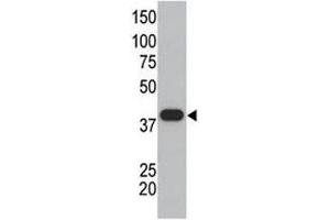 SUMO polyclonal antibody used in western blot to detect GST-SUMO1 fusion protein. (SUMO1 抗体  (AA 55-86))