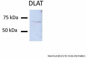 Sample Type: Huh7 lysate (50ug)Primary Antibody Dilution: 1:200Image Submitted By: Partha KasturiUniversity of Kansas Medical Center (DLAT 抗体  (N-Term))