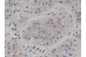 DAB staining on IHC-P; Samples: Human Stomach Tissue (Nestin 抗体  (AA 178-399))