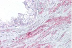 Immunohistochemistry with Prostate tissue at an antibody concentration of 5µg/ml using anti-TRPM8 antibody (ARP35357_P050) (TRPM8 抗体  (N-Term))