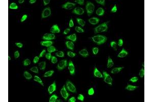 Immunofluorescence analysis of A-549 cells using HSD3B2 antibody (ABIN6131145, ABIN6142018, ABIN6142019 and ABIN6218943). (HSD3B2 抗体  (AA 1-287))