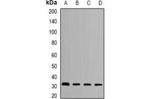 Western blot analysis of HMGCL expression in SKOV3 (A), MCF7 (B), mouse liver (C), mouse kidney (D) whole cell lysates. (HMGCL 抗体)