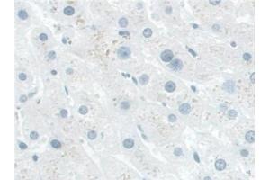 Immunohistochemistry (IHC) image for anti-NAD Kinase (NADK) (AA 187-426) antibody (ABIN7436492)