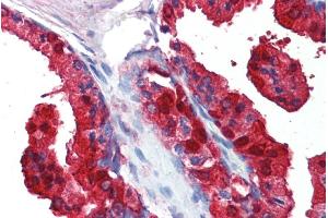 ABIN185332 (5µg/ml) staining of paraffin embedded Human Prostate. (SORD 抗体  (C-Term))