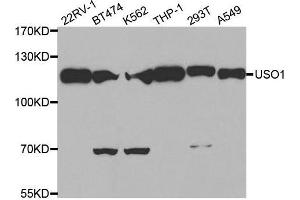 Western blot analysis of extracts of various cell lines, using USO1 antibody. (USO1 抗体)