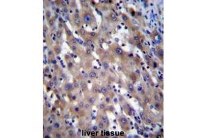 RPGR Antibody (C-term) immunohistochemistry analysis in formalin fixed and paraffin embedded human liver tissue followed by peroxidase conjugation of the secondary antibody and DAB staining.