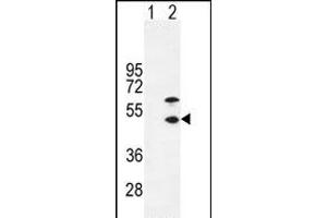 Western blot analysis of CKM (arrow) using rabbit polyclonal CKM-T6 (ABIN391095 and ABIN2841234). (CKM 抗体  (N-Term))