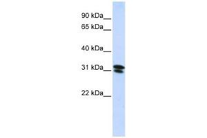 RNF182 antibody used at 1 ug/ml to detect target protein. (RNF182 抗体  (N-Term))