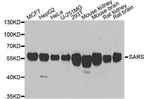 Western blot analysis of extracts of various cell lines, using SARS antibody. (Seryl-tRNA Synthetase (SARS) (AA 1-300) 抗体)
