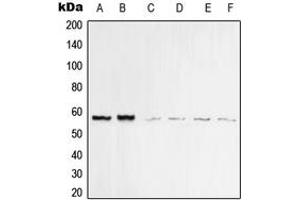 Western blot analysis of Vimentin expression in MCF7 (A), MDAMB435 (B), KNRK (C), HeLa (D), Raw264. (Vimentin 抗体  (C-Term))
