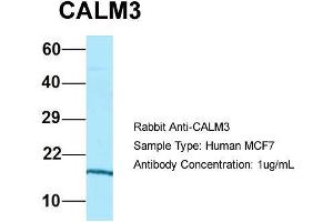 Host: Rabbit  Target Name: CALM3  Sample Tissue: Human MCF7  Antibody Dilution: 1.