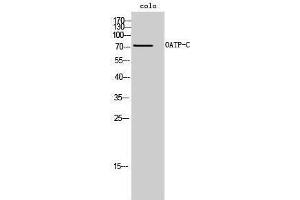 Western Blotting (WB) image for anti-Solute Carrier Organic Anion Transporter Family, Member 1B1 (SLCO1B1) (Internal Region) antibody (ABIN3185986) (SLCO1B1 抗体  (Internal Region))