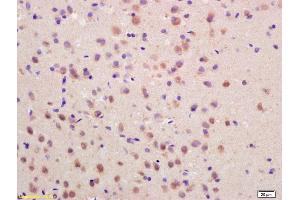 Formalin-fixed and paraffin embedded rat brain labeled with Rabbit Anti SOCS3 Polyclonal Antibody, Unconjugated (ABIN670416) at 1:200 followed by conjugation to the secondary antibody and DAB staining (SOCS3 抗体  (AA 155-225))