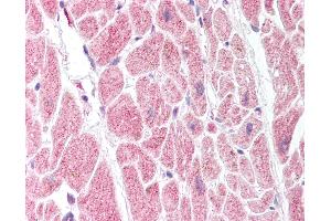 Immunohistochemistry (IHC) image for anti-Prostaglandin I2 (Prostacyclin) Synthase (PTGIS) (AA 475-490) antibody (ABIN2451652)