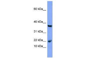 WB Suggested Anti-MB Antibody Titration:  0. (MB 抗体  (N-Term))