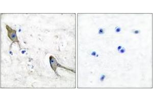 Immunohistochemistry analysis of paraffin-embedded human brain tissue, using PYK2 (Ab-881) Antibody. (PTK2B 抗体  (AA 847-896))