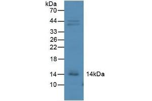 Detection of IP10 in Mouse Kidney Tissue using Polyclonal Antibody to Interferon Gamma Induced Protein 10 kDa (IP10) (CXCL10 抗体  (AA 22-98))