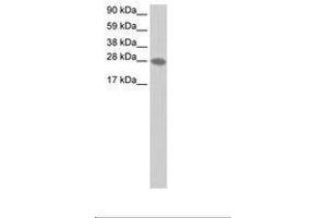 Image no. 1 for anti-Transcription Elongation Factor A2 (TCEA2) (AA 45-94) antibody (ABIN202191) (TCEA2 抗体  (AA 45-94))