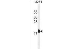 Western Blotting (WB) image for anti-Multiple Coagulation Factor Deficiency 2 (MCFD2) antibody (ABIN2995326) (MCFD2 抗体)