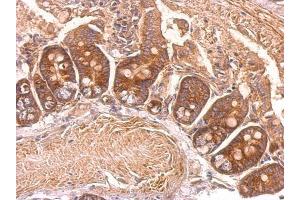 IHC-P Image eEF2 antibody detects eEF2 protein at cytosol on mouse intestine by immunohistochemical analysis. (EEF2 抗体)