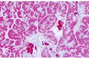 Image no. 2 for anti-Lysophospholipase-Like Protein 1 (LYPLAL1) (C-Term) antibody (ABIN6749790) (LYPLAL1 抗体  (C-Term))