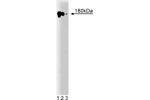 Western Blotting (WB) image for anti-Epidermal Growth Factor Receptor (EGFR) (AA 1020-1046) antibody (ABIN967697) (EGFR 抗体  (AA 1020-1046))